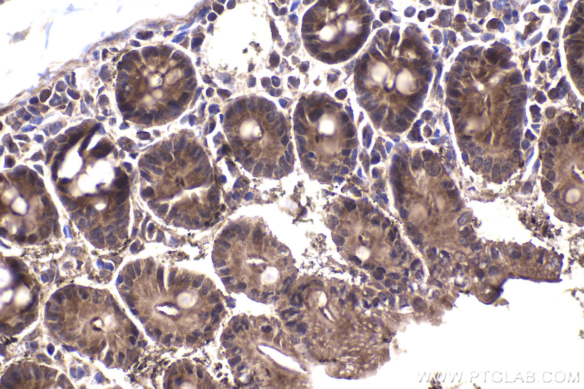 Immunohistochemical analysis of paraffin-embedded mouse intestine tissue slide using KHC1972 (DACT1 IHC Kit).