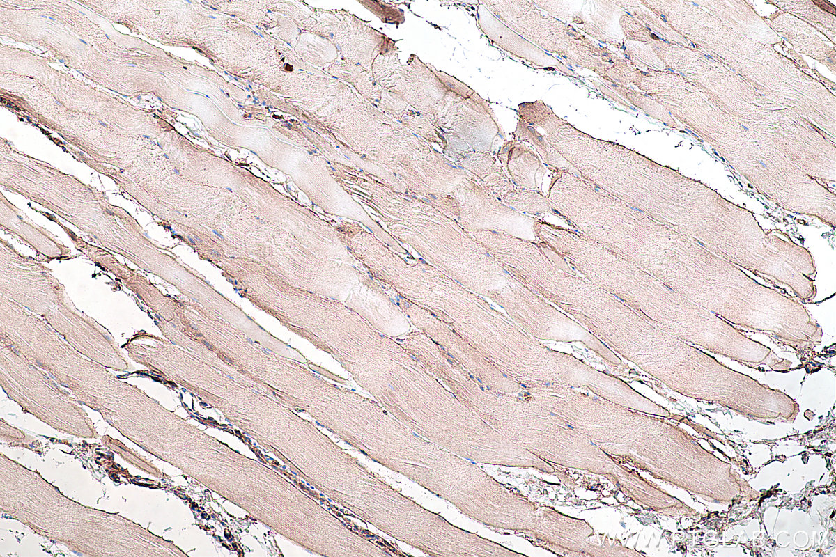 Immunohistochemical analysis of paraffin-embedded rat skeletal muscle tissue slide using KHC0285 (DAG1 IHC Kit).
