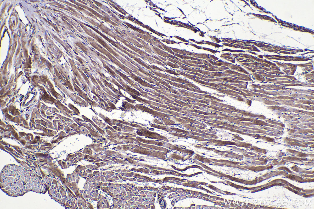 Immunohistochemical analysis of paraffin-embedded rat heart tissue slide using KHC1452 (DAPK3 IHC Kit).