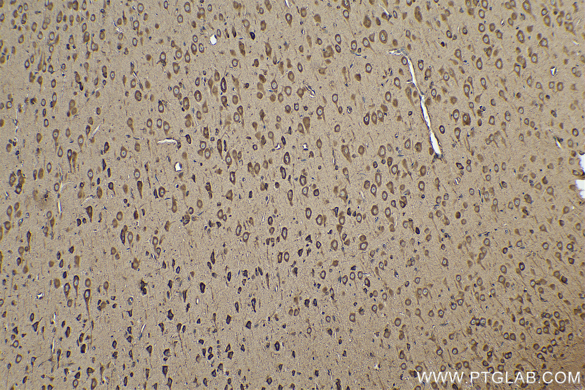 Immunohistochemical analysis of paraffin-embedded rat brain tissue slide using KHC0843 (DARS IHC Kit).