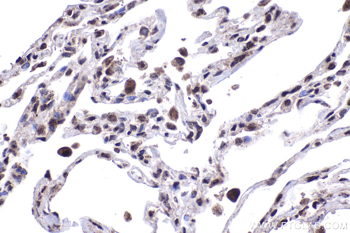 Immunohistochemical analysis of paraffin-embedded human lung tissue slide using KHC1977 (DAXX IHC Kit).