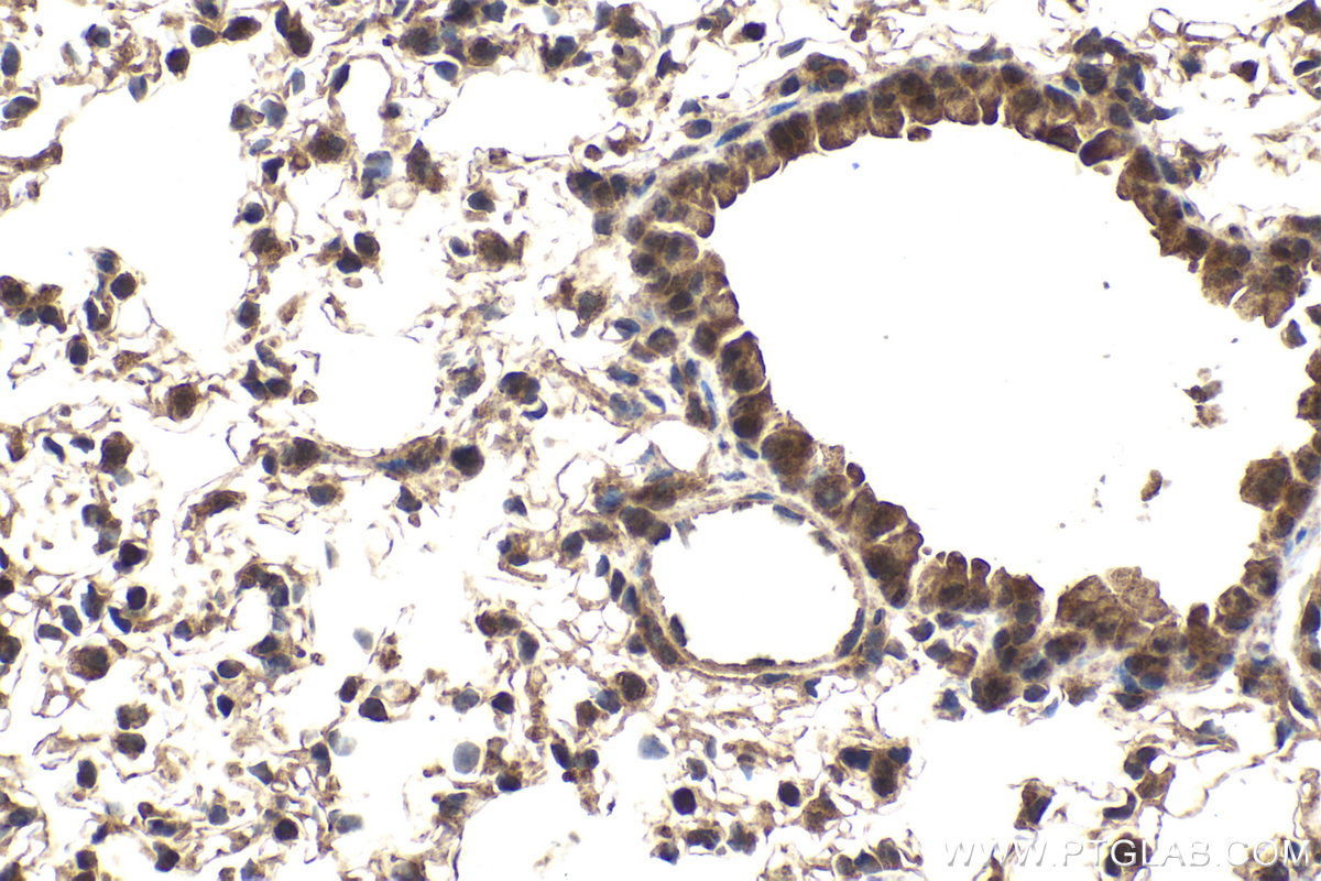 Immunohistochemical analysis of paraffin-embedded mouse lung tissue slide using KHC2022 (DCAF1/VPRBP IHC Kit).