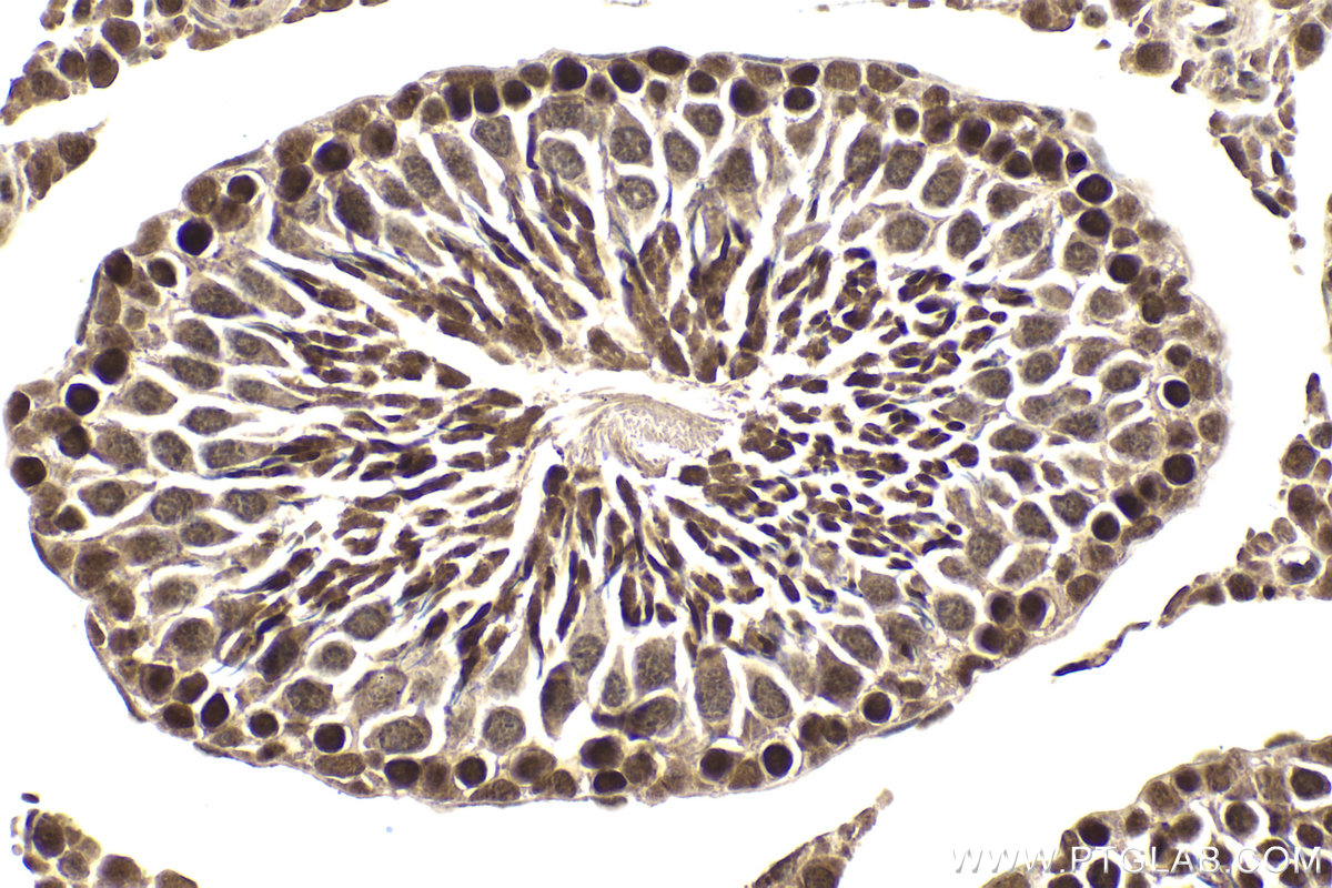 Immunohistochemical analysis of paraffin-embedded rat testis tissue slide using KHC2022 (DCAF1/VPRBP IHC Kit).