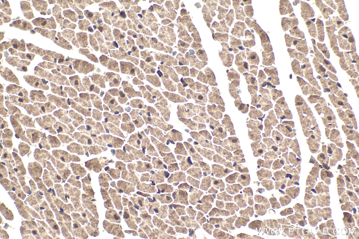 Immunohistochemical analysis of paraffin-embedded rat heart tissue slide using KHC1956 (DCP1A IHC Kit).