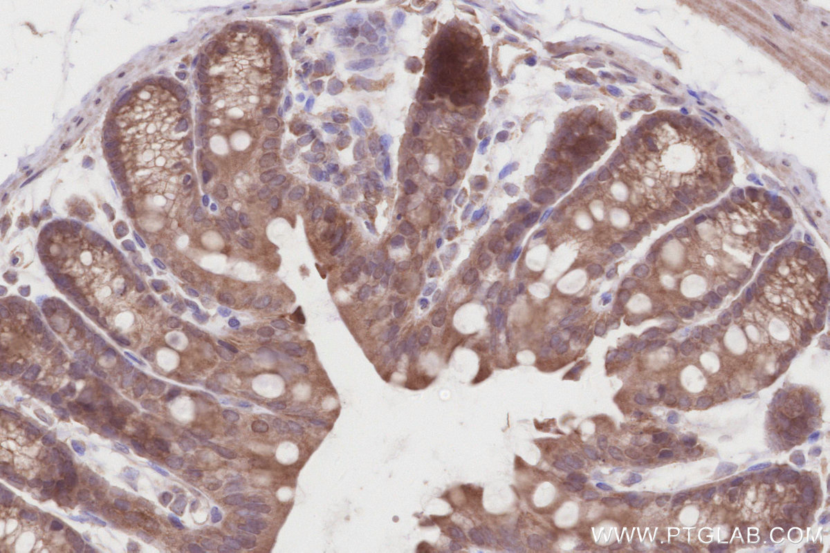 Immunohistochemical analysis of paraffin-embedded mouse colon tissue slide using KHC2866 (DCTN5 IHC Kit).