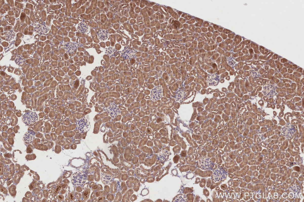 Immunohistochemical analysis of paraffin-embedded mouse kidney tissue slide using KHC2866 (DCTN5 IHC Kit).