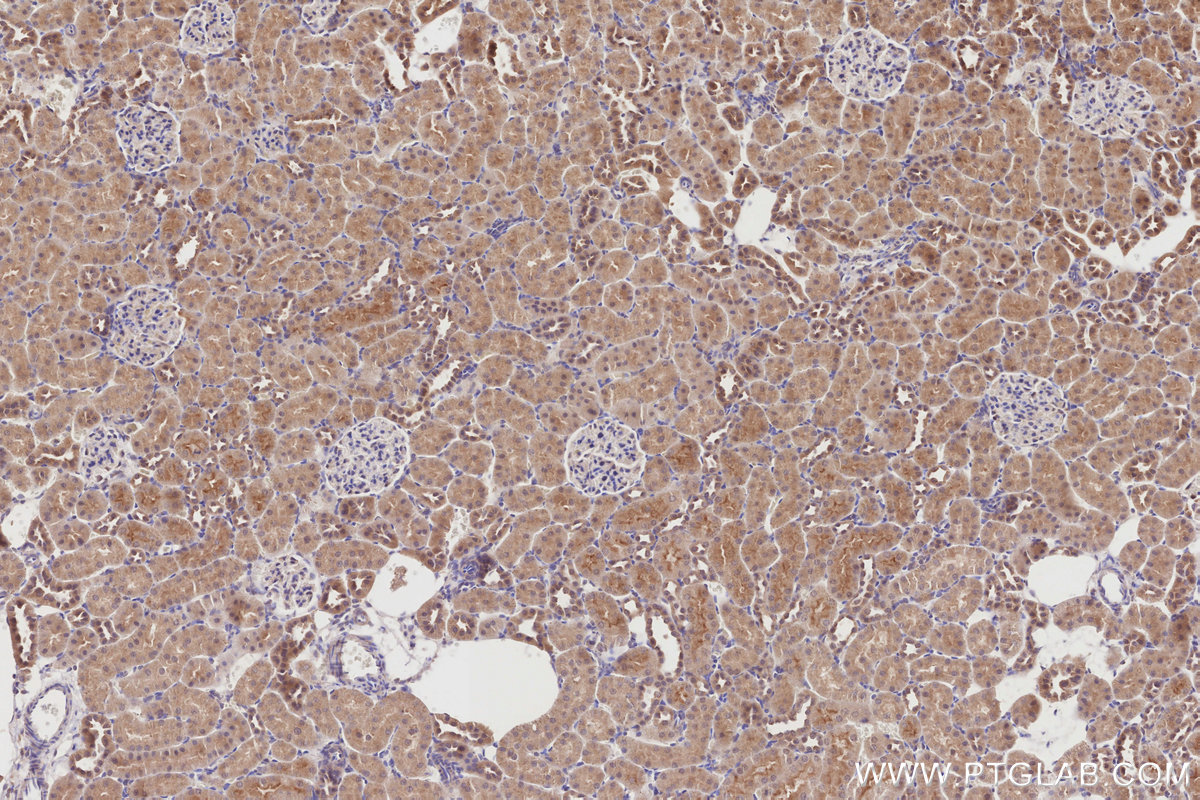 Immunohistochemical analysis of paraffin-embedded rat kidney tissue slide using KHC2866 (DCTN5 IHC Kit).