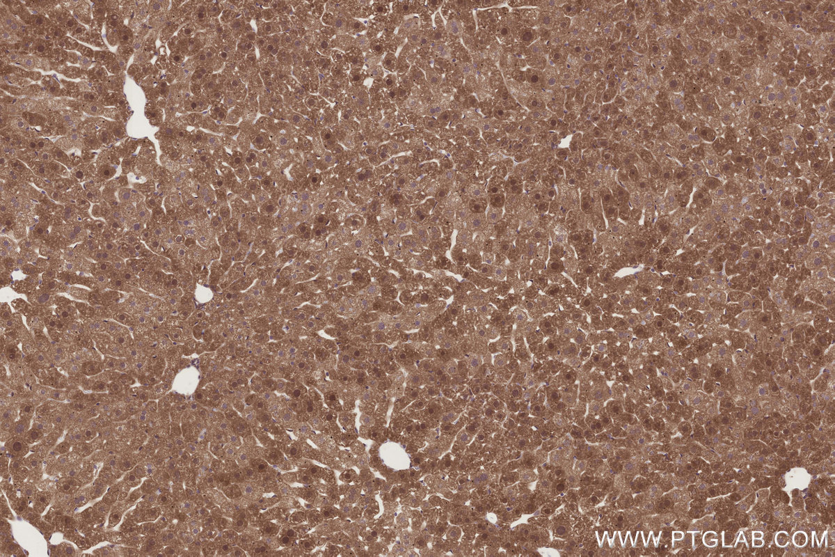 Immunohistochemical analysis of paraffin-embedded mouse liver tissue slide using KHC3272 (DCUN1D2 IHC Kit). Immunohistochemical analysis of paraffin-embedded mouse liver tissue slide using KHC3272 (DCUN1D2 IHC Kit).