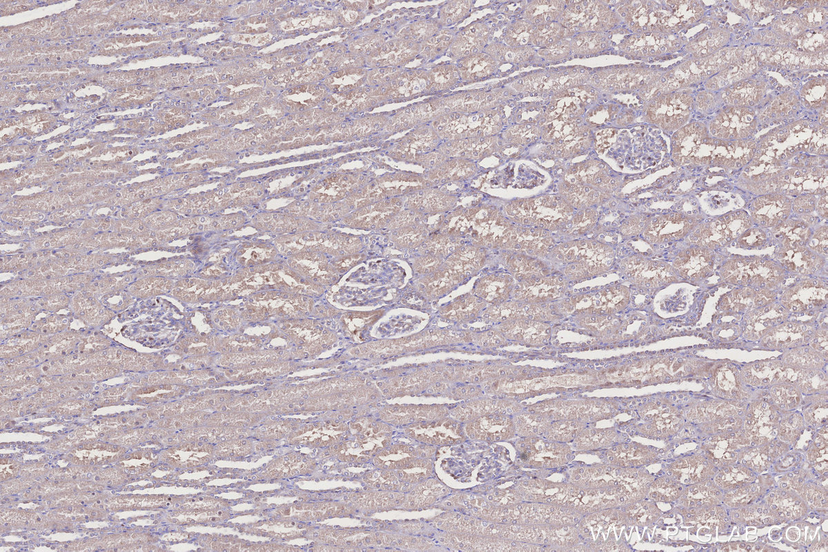 Immunohistochemical analysis of paraffin-embedded human kidney tissue slide using KHC3272 (DCUN1D2 IHC Kit). Immunohistochemical analysis of paraffin-embedded human kidney tissue slide using KHC3272 (DCUN1D2 IHC Kit).