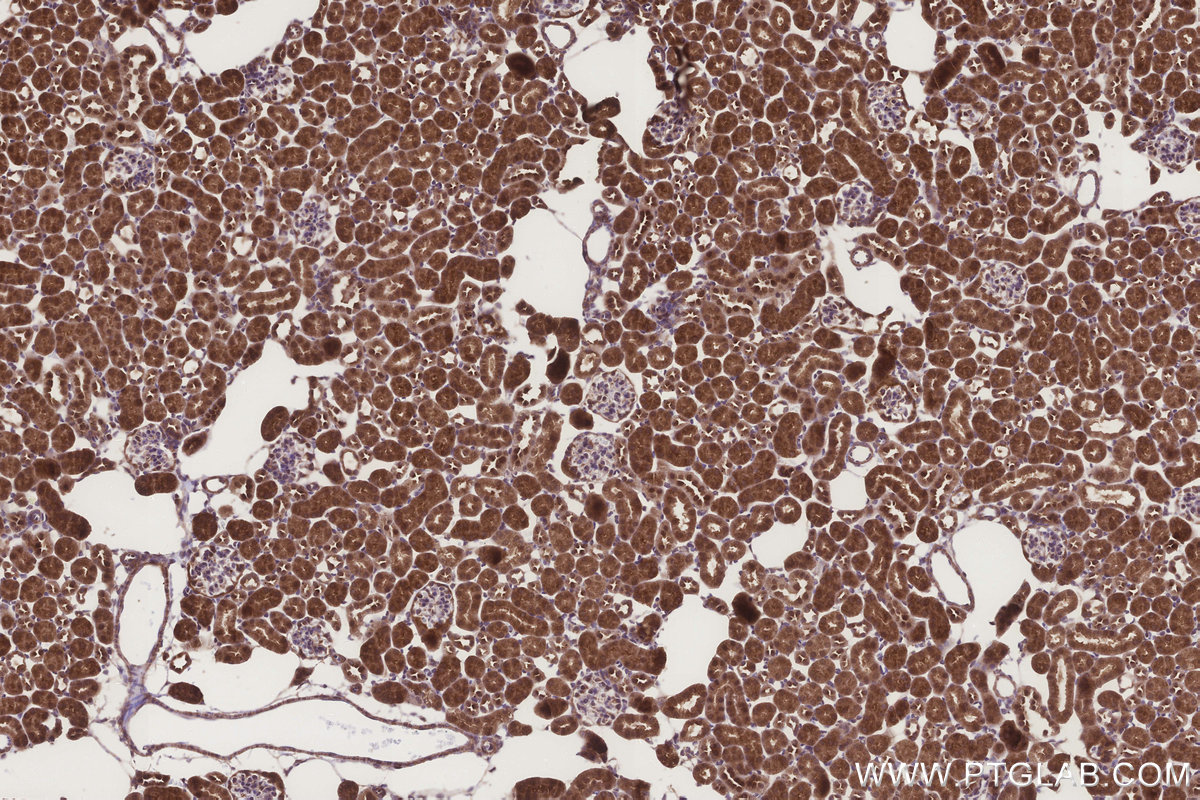 Immunohistochemical analysis of paraffin-embedded mouse kidney tissue slide using KHC3272 (DCUN1D2 IHC Kit). Immunohistochemical analysis of paraffin-embedded mouse kidney tissue slide using KHC3272 (DCUN1D2 IHC Kit).