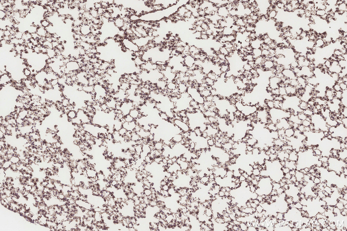 Immunohistochemical analysis of paraffin-embedded mouse lung tissue slide using KHC3272 (DCUN1D2 IHC Kit). Immunohistochemical analysis of paraffin-embedded mouse lung tissue slide using KHC3272 (DCUN1D2 IHC Kit).