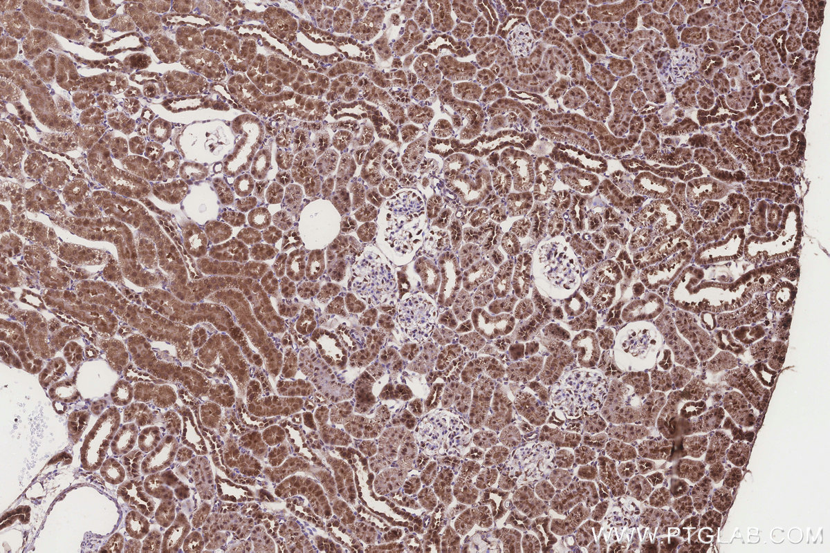 Immunohistochemical analysis of paraffin-embedded rat kidney tissue slide using KHC3272 (DCUN1D2 IHC Kit). Immunohistochemical analysis of paraffin-embedded rat kidney tissue slide using KHC3272 (DCUN1D2 IHC Kit).