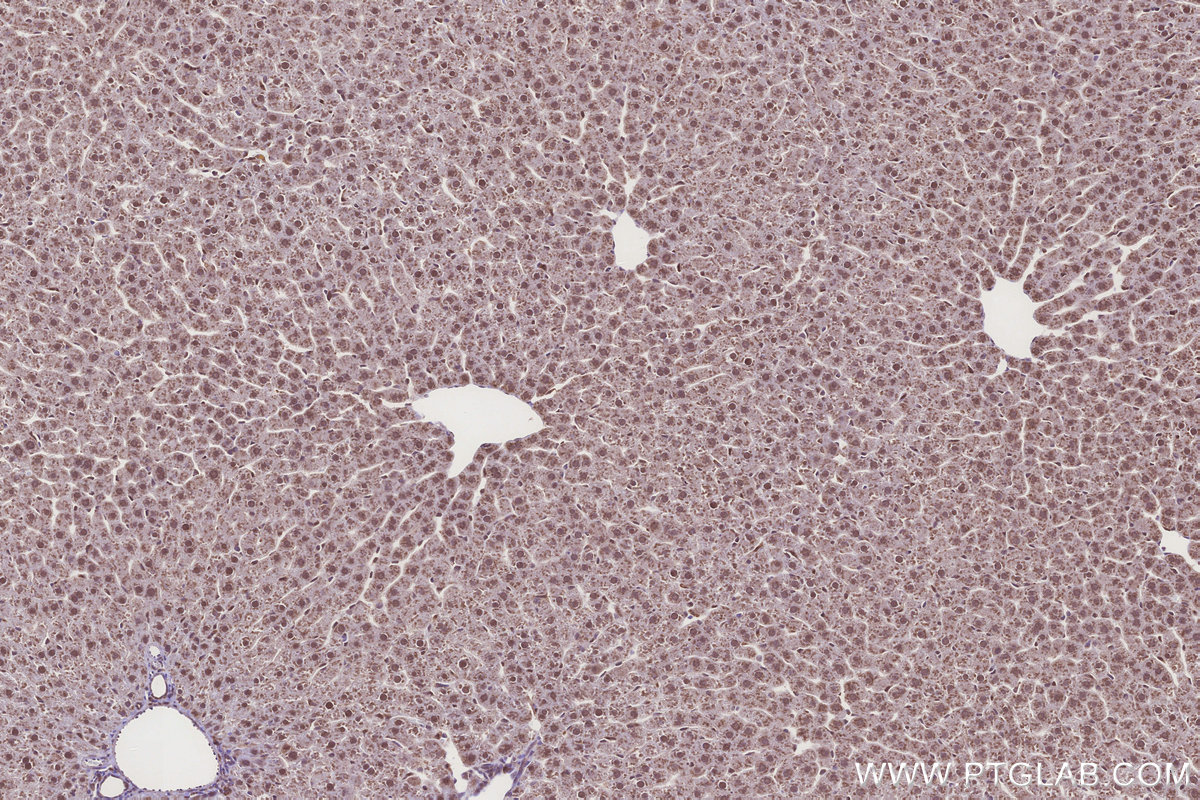 Immunohistochemical analysis of paraffin-embedded rat liver tissue slide using KHC3272 (DCUN1D2 IHC Kit). Immunohistochemical analysis of paraffin-embedded rat liver tissue slide using KHC3272 (DCUN1D2 IHC Kit).