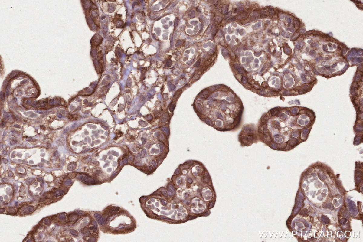 Immunohistochemical analysis of paraffin-embedded human placenta tissue slide using KHC2651 (DCUN1D3 IHC Kit).