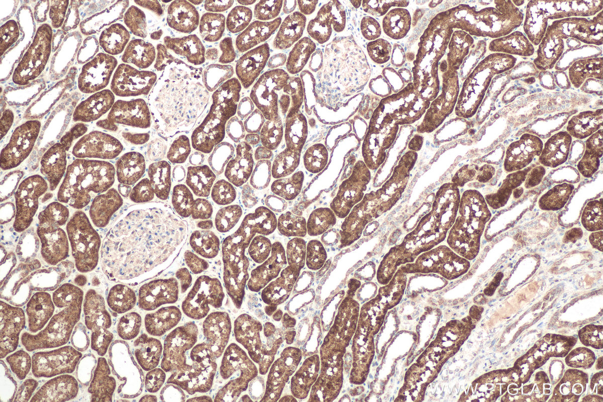 Immunohistochemical analysis of paraffin-embedded human kidney tissue slide using KHC0611 (DDC IHC Kit).