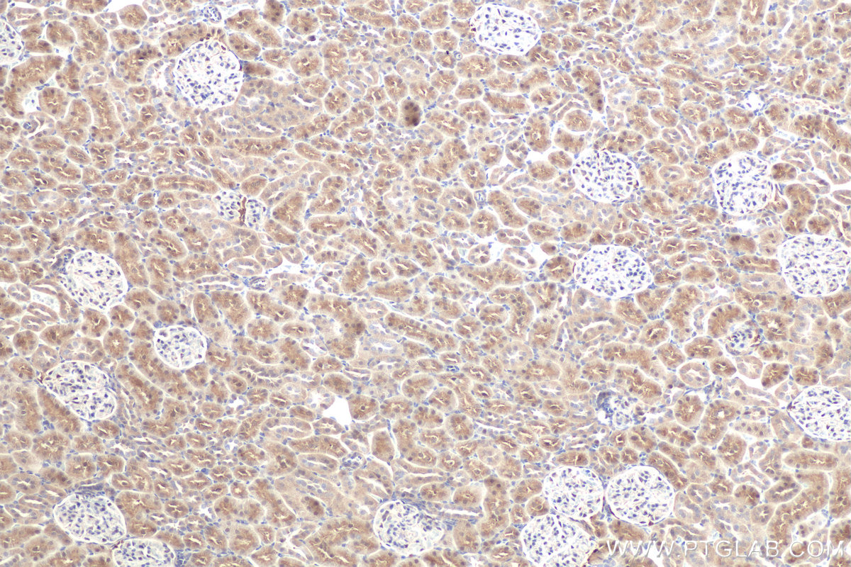 Immunohistochemical analysis of paraffin-embedded rat kidney tissue slide using KHC0611 (DDC IHC Kit).