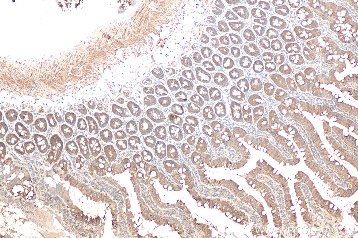 Immunohistochemical analysis of paraffin-embedded rat small intestine tissue slide using KHC0611 (DDC IHC Kit).