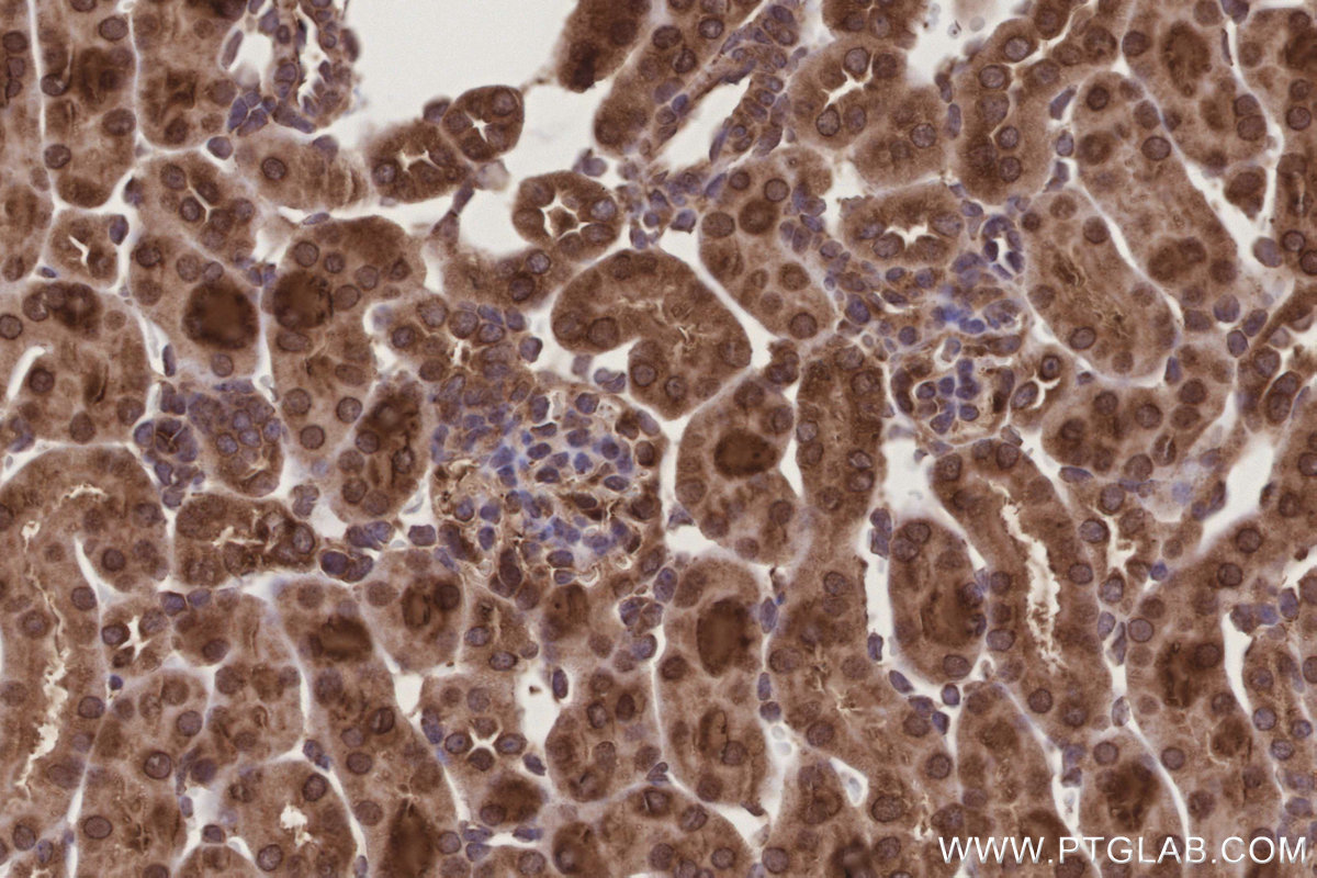 Immunohistochemical analysis of paraffin-embedded mouse kidney tissue slide using KHC3208 (DDOST IHC Kit). Immunohistochemical analysis of paraffin-embedded mouse kidney tissue slide using KHC3208 (DDOST IHC Kit).
