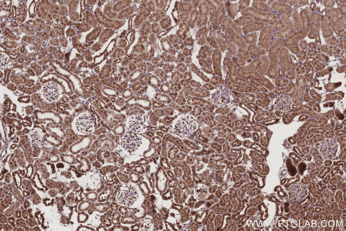 Immunohistochemical analysis of paraffin-embedded rat kidney tissue slide using KHC3208 (DDOST IHC Kit). Immunohistochemical analysis of paraffin-embedded rat kidney tissue slide using KHC3208 (DDOST IHC Kit).