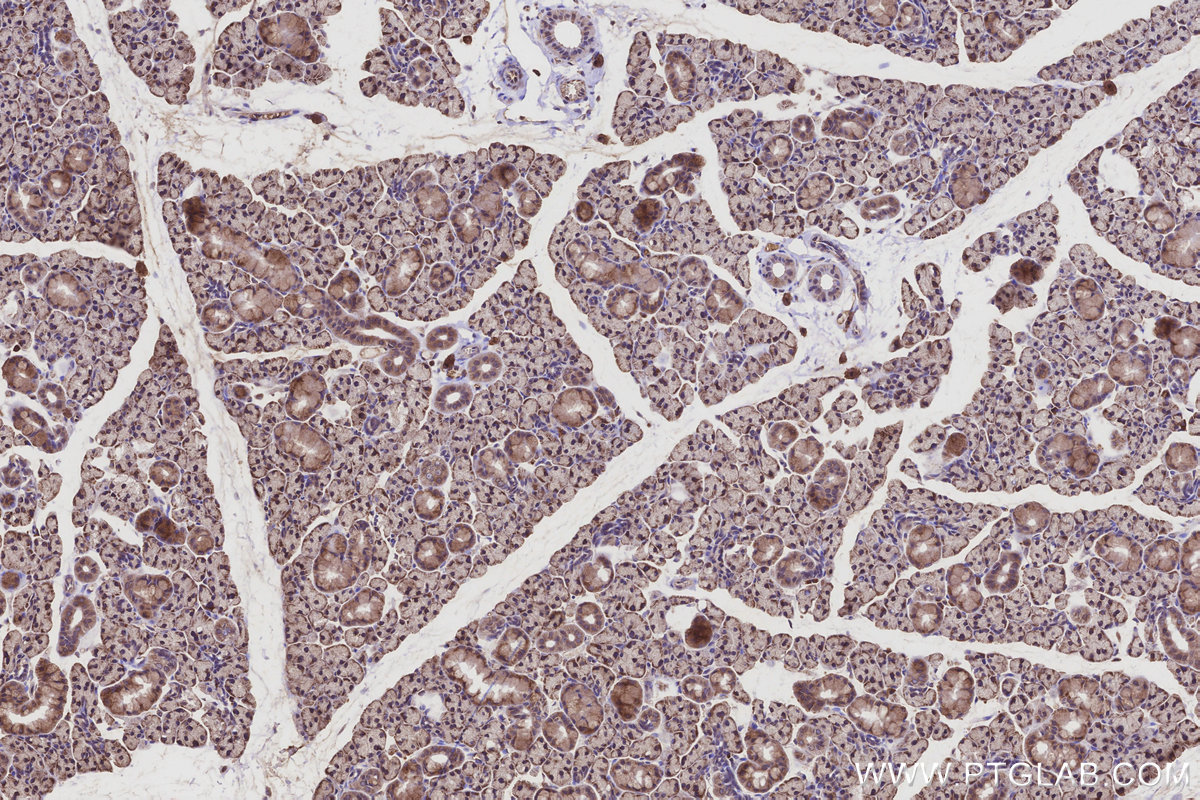 Immunohistochemical analysis of paraffin-embedded rat salivary gland tissue slide using KHC3208 (DDOST IHC Kit). Immunohistochemical analysis of paraffin-embedded rat salivary gland tissue slide using KHC3208 (DDOST IHC Kit).