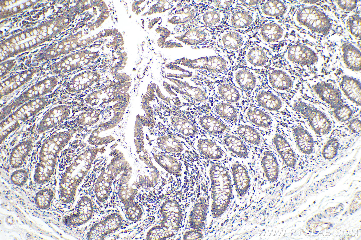 Immunohistochemical analysis of paraffin-embedded human colon tissue slide using KHC0129 (DDR1 IHC Kit).