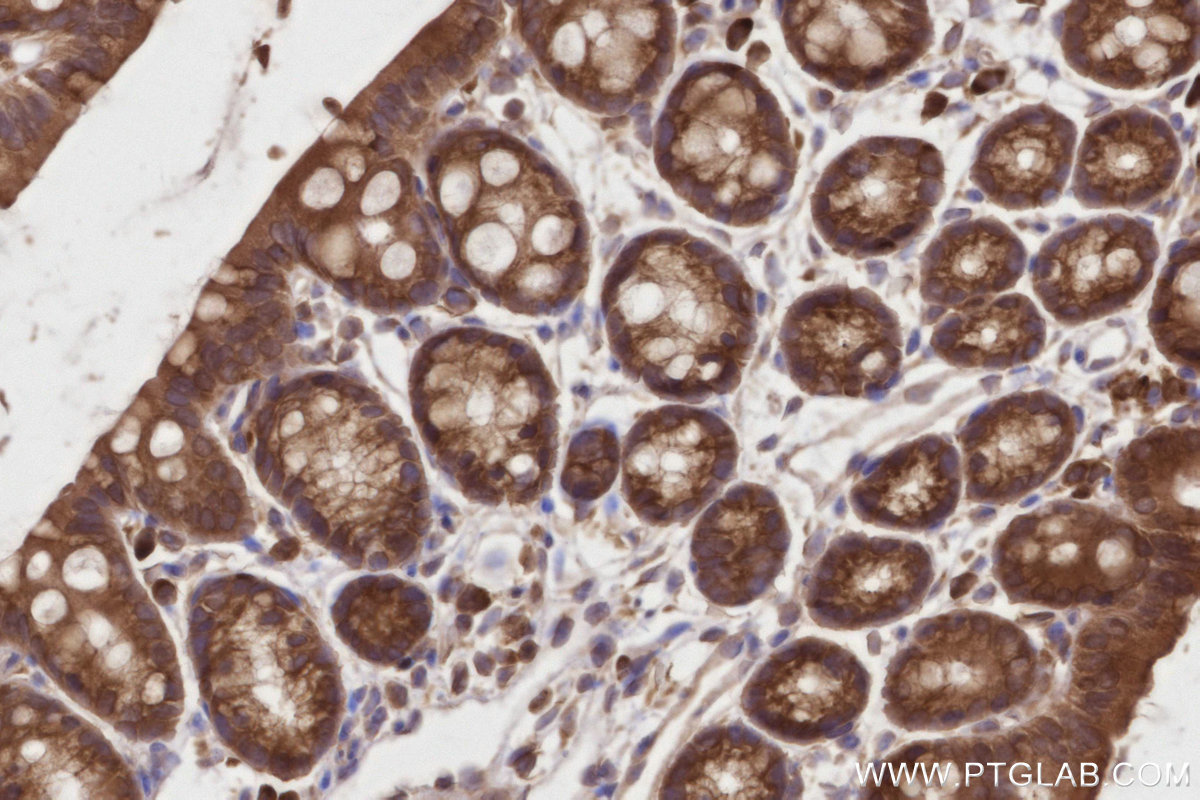 Immunohistochemical analysis of paraffin-embedded mouse colon tissue slide using KHC2799 (DDRGK1 IHC Kit).