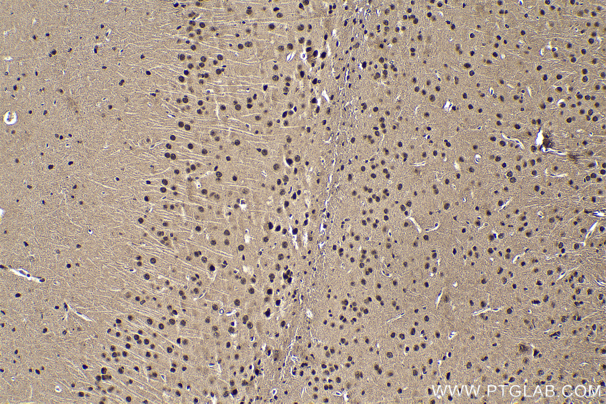 Immunohistochemical analysis of paraffin-embedded mouse brain tissue slide using KHC1847 (DDX1 IHC Kit).