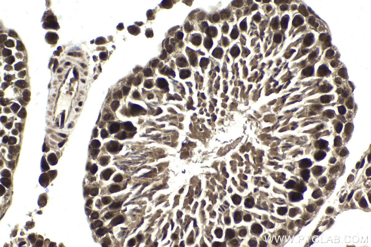 Immunohistochemical analysis of paraffin-embedded rat testis tissue slide using KHC1859 (DDX17 IHC Kit).