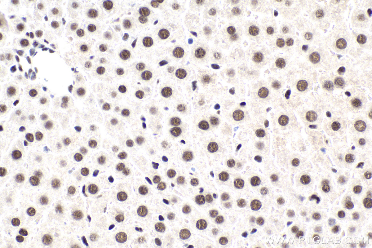 Immunohistochemical analysis of paraffin-embedded mouse liver tissue slide using KHC1905 (DDX23 IHC Kit).