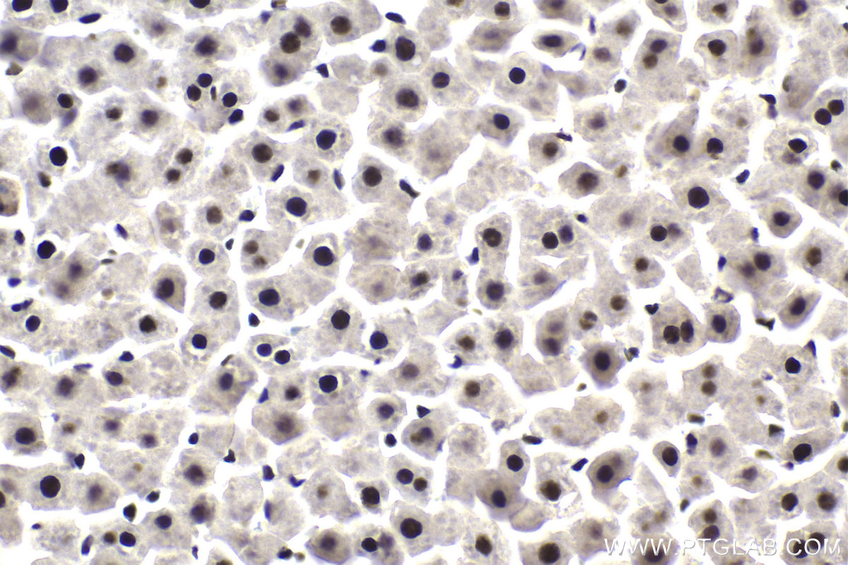 Immunohistochemical analysis of paraffin-embedded rat liver tissue slide using KHC1905 (DDX23 IHC Kit).