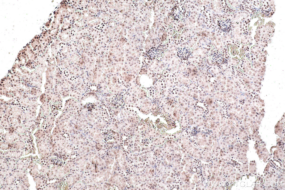 Immunohistochemical analysis of paraffin-embedded mouse kidney tissue slide using KHC0928 (DDX39A IHC Kit).