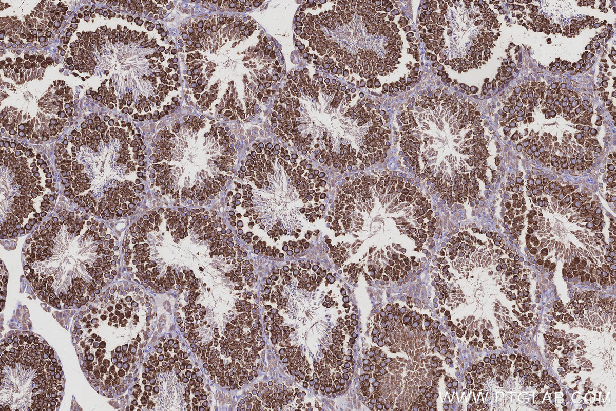 Immunohistochemical analysis of paraffin-embedded mouse testis tissue slide using KHC2943 (DDX4/VASA IHC Kit).