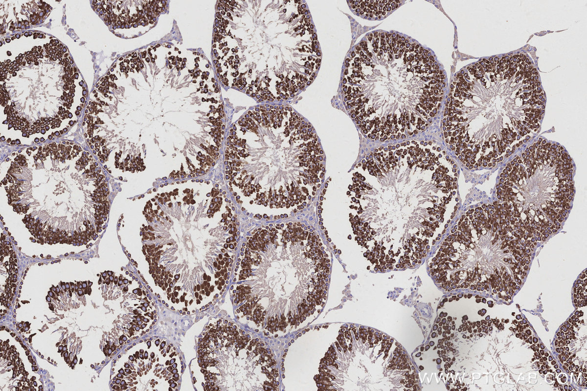 Immunohistochemical analysis of paraffin-embedded rat testis tissue slide using KHC2943 (DDX4/VASA IHC Kit).
