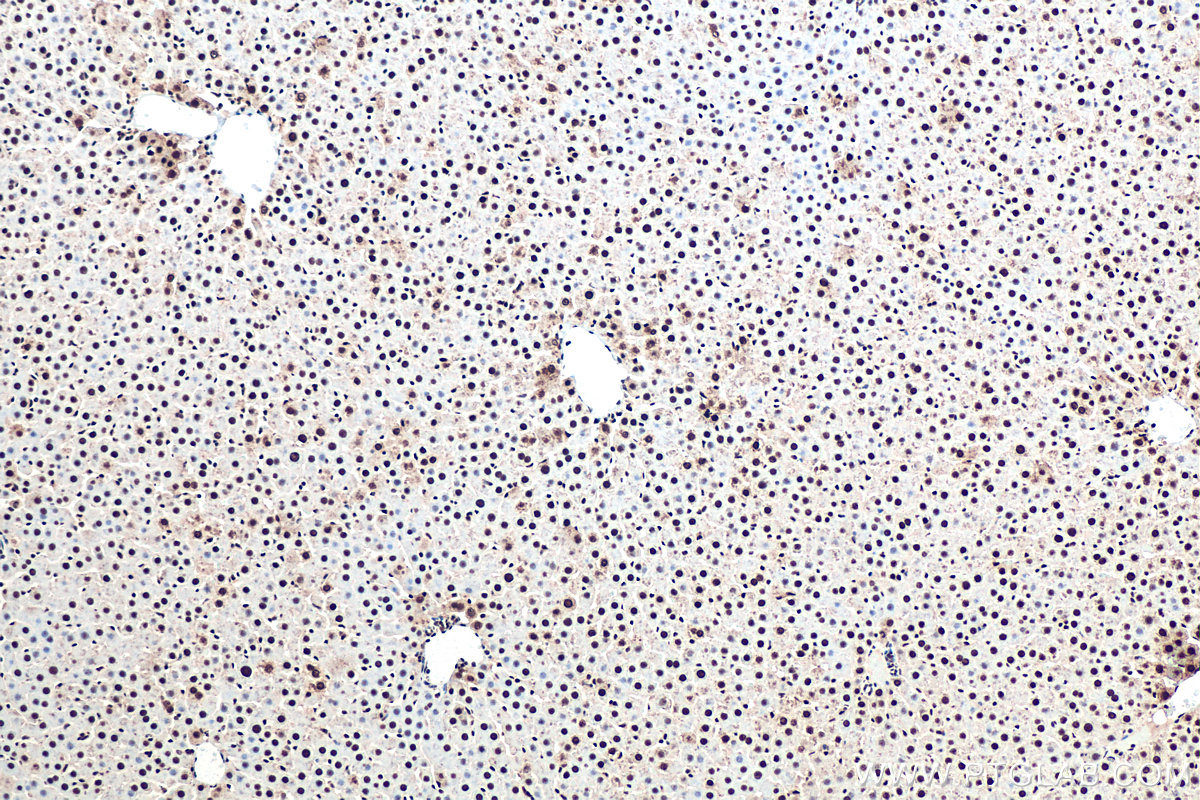 Immunohistochemical analysis of paraffin-embedded rat liver tissue slide using KHC0913 (DDX5 IHC Kit).