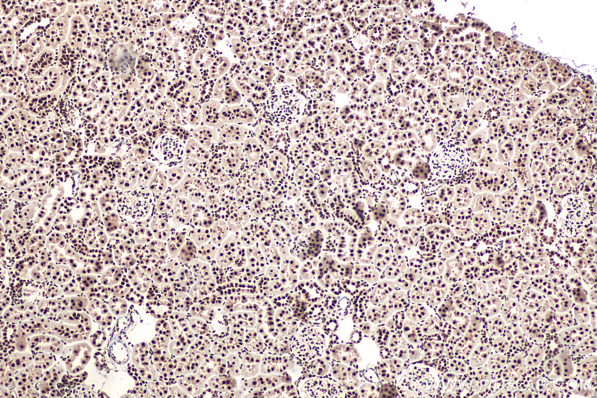 Immunohistochemical analysis of paraffin-embedded rat kidney tissue slide using KHC0913 (DDX5 IHC Kit).