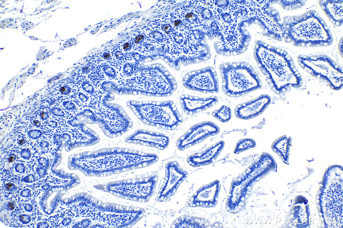 Immunohistochemical analysis of paraffin-embedded human small intestine tissue slide using KHC1169 (DEFA6 IHC Kit).