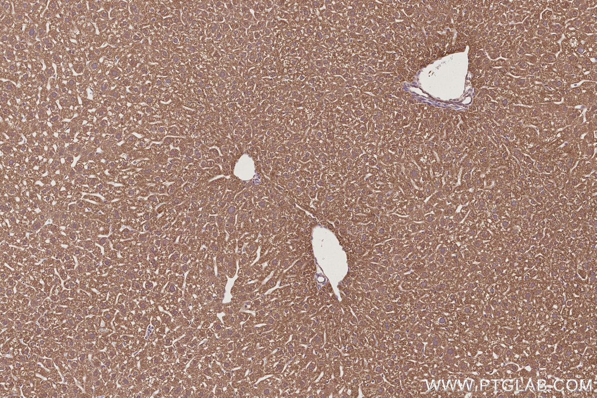 Immunohistochemical analysis of paraffin-embedded mouse liver tissue slide using KHC2800 (DHTKD1 IHC Kit).