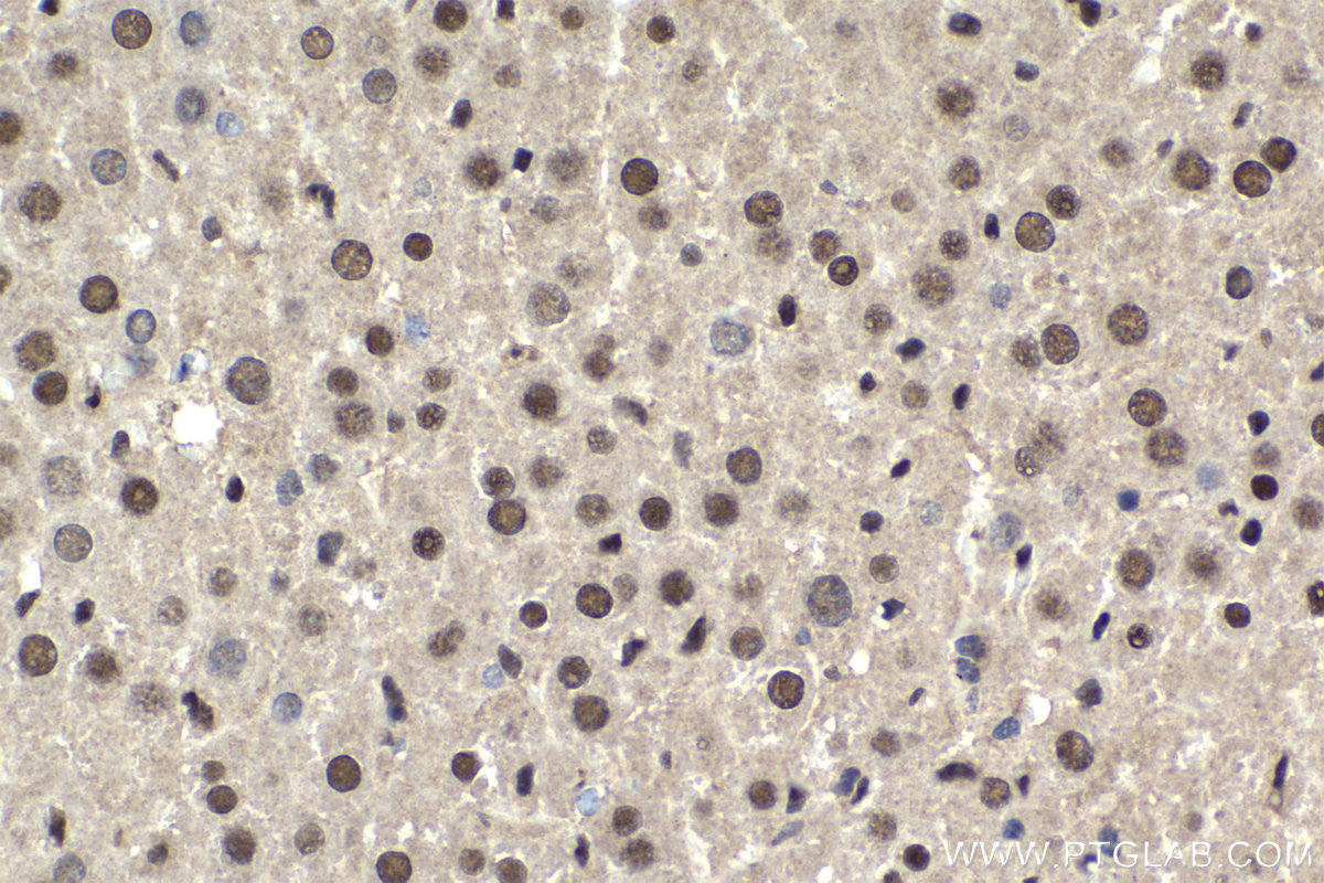 Immunohistochemical analysis of paraffin-embedded mouse liver tissue slide using KHC1848 (DHX38 IHC Kit).