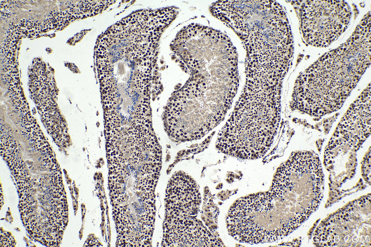 Immunohistochemical analysis of paraffin-embedded mouse testis tissue slide using KHC1685 (DHX9 IHC Kit).