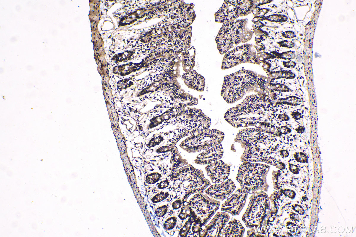 Immunohistochemical analysis of paraffin-embedded mouse small intestine tissue slide using KHC1685 (DHX9 IHC Kit).