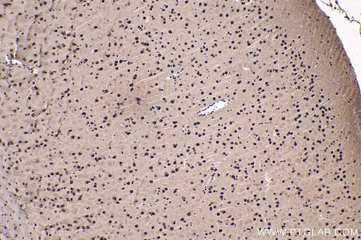 Immunohistochemical analysis of paraffin-embedded rat brain tissue slide using KHC1685 (DHX9 IHC Kit).