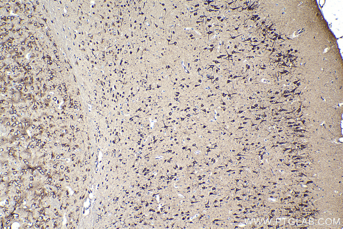 Immunohistochemical analysis of paraffin-embedded mouse brain tissue slide using KHC2100 (DIAPH1 IHC Kit).