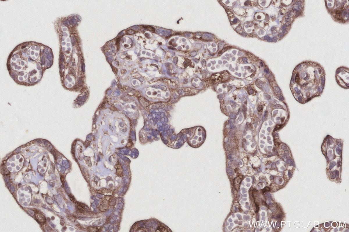 Immunohistochemical analysis of paraffin-embedded human placenta tissue slide using KHC2954 (DIAPH3 IHC Kit).