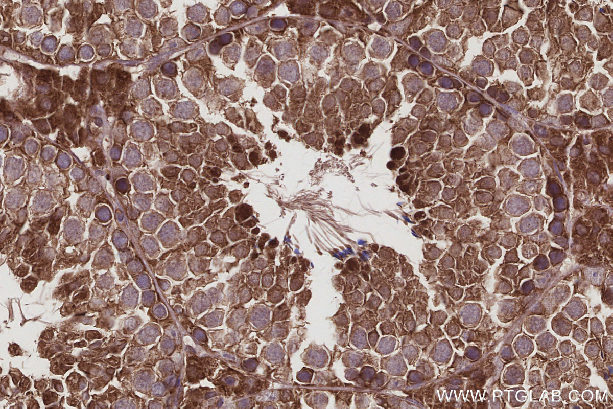 Immunohistochemical analysis of paraffin-embedded mouse testis tissue slide using KHC2954 (DIAPH3 IHC Kit).
