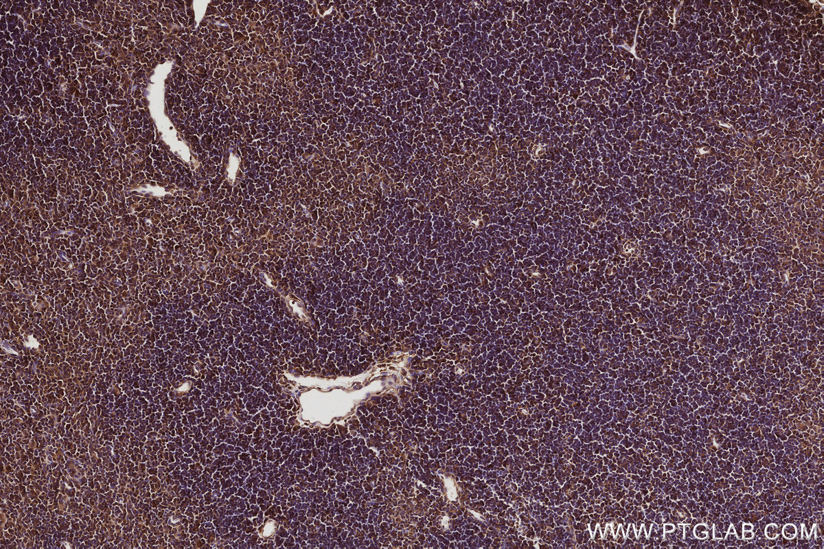 Immunohistochemical analysis of paraffin-embedded mouse thymus tissue slide using KHC2954 (DIAPH3 IHC Kit).