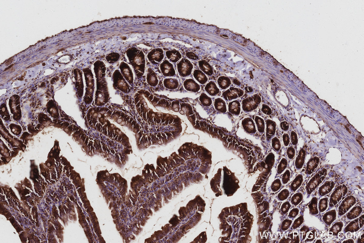 Immunohistochemical analysis of paraffin-embedded rat small intestine tissue slide using KHC2954 (DIAPH3 IHC Kit).