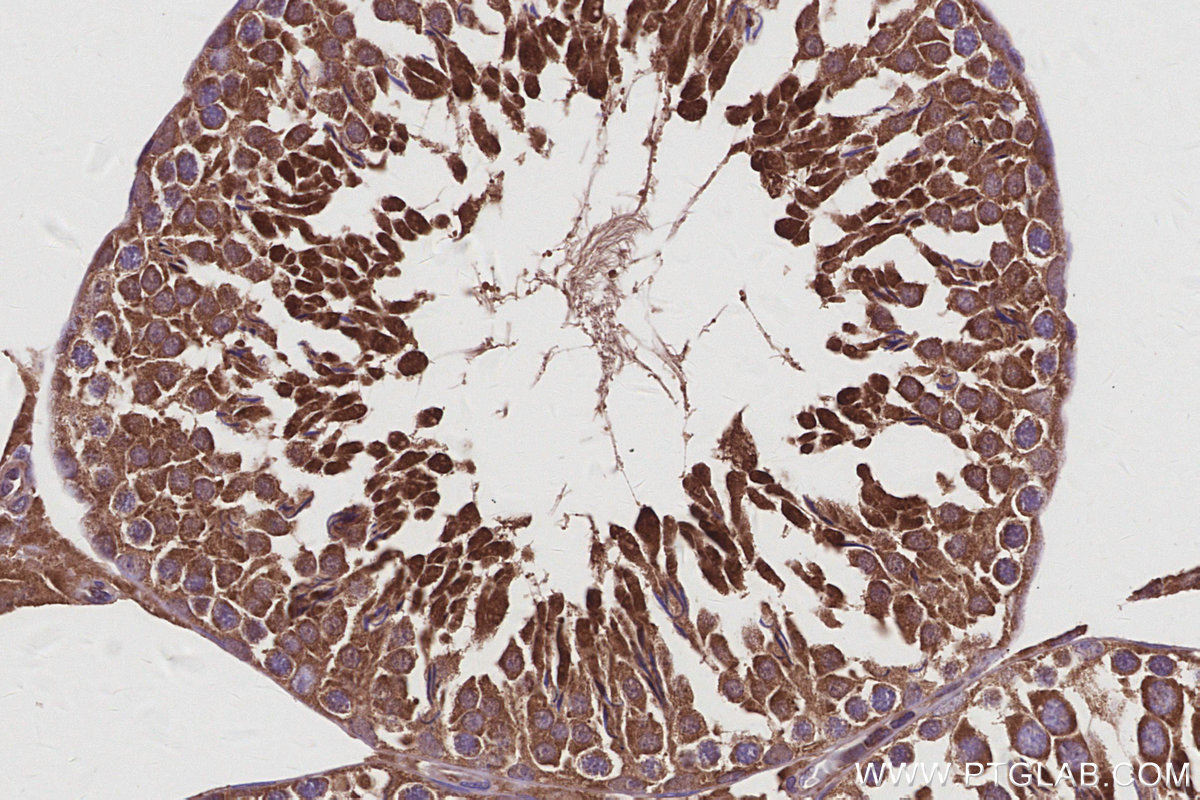 Immunohistochemical analysis of paraffin-embedded rat testis tissue slide using KHC2954 (DIAPH3 IHC Kit).