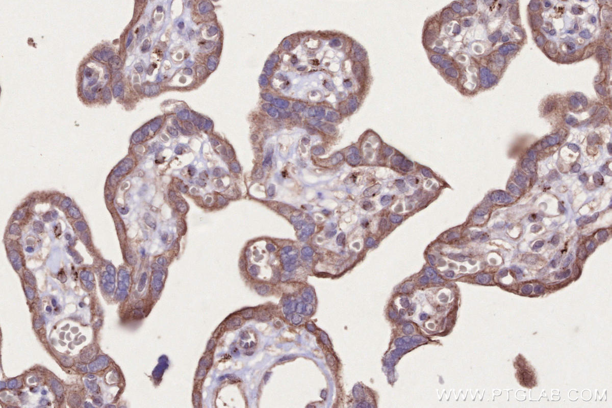 Immunohistochemical analysis of paraffin-embedded human placenta tissue slide using KHC2689 (DIPK2A/C3orf58 IHC Kit).