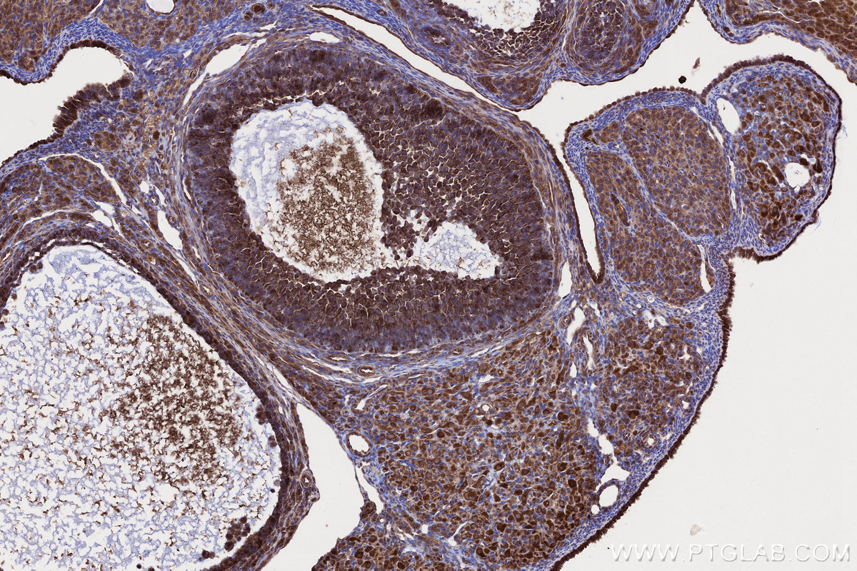Immunohistochemical analysis of paraffin-embedded rat ovary tissue slide using KHC2659 (DIS3L2 IHC Kit).