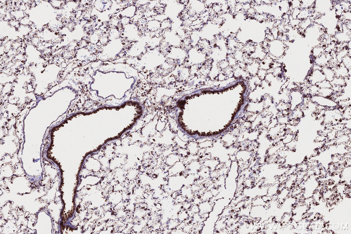 Immunohistochemical analysis of paraffin-embedded rat lung tissue slide using KHC2659 (DIS3L2 IHC Kit).